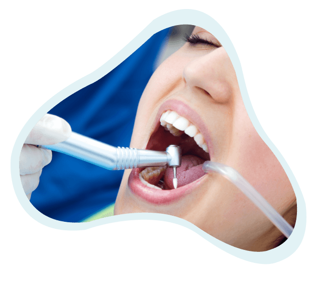 dental-crowns Dental Office in Naperville, IL