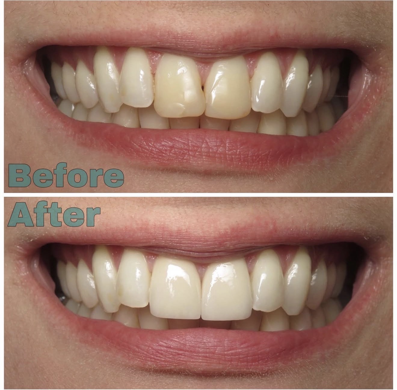 Dental Office in Naperville, IL