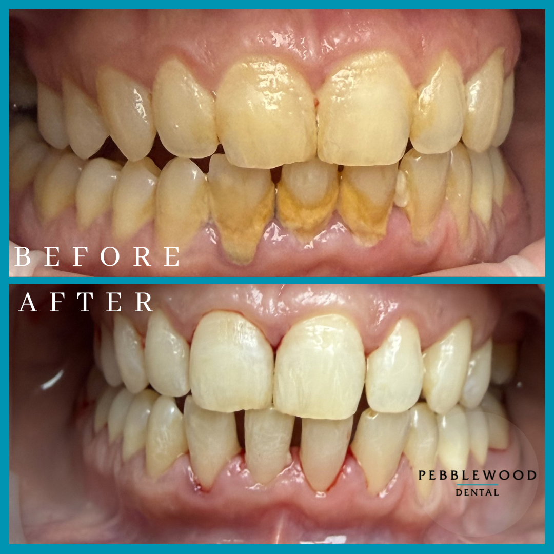 Dental Office in Naperville, IL