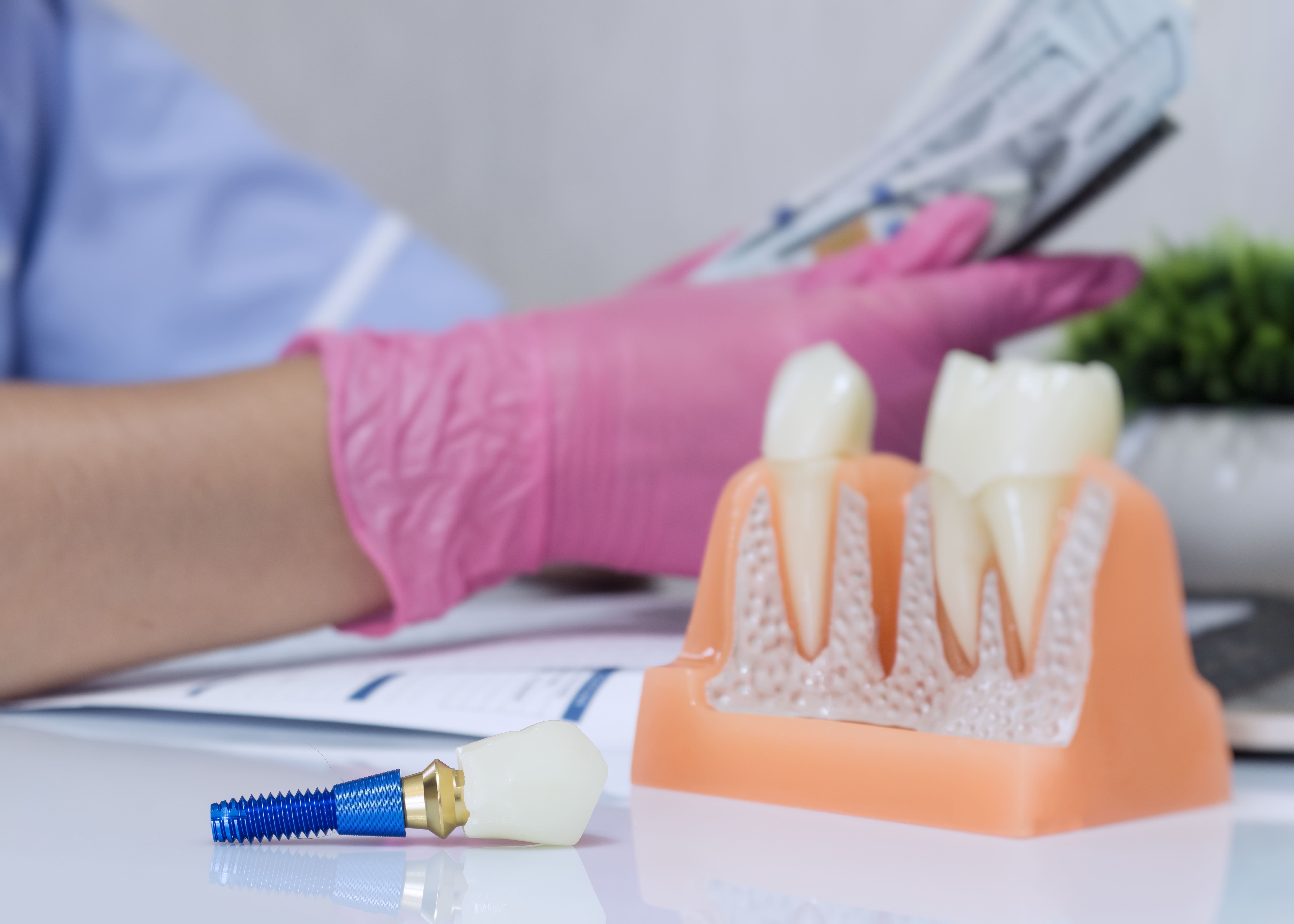 How Much Does a Dental Implant Cost in Naperville?